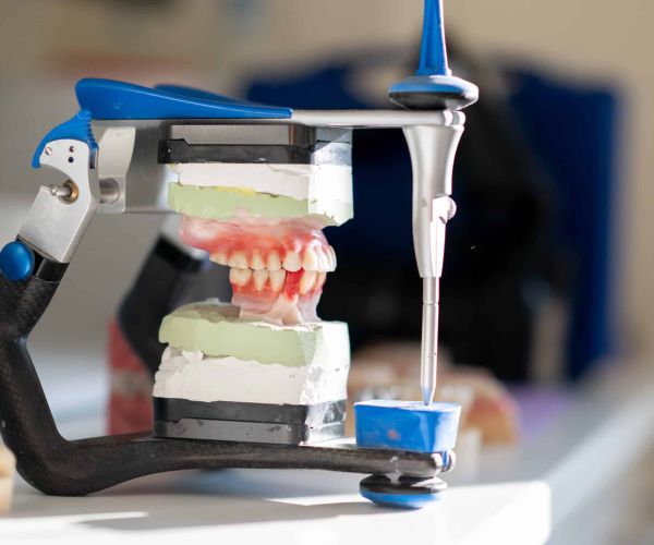 Zahntechnischer Artikulator mit einem Gebissmodell zur Analyse der Kieferbewegungen.